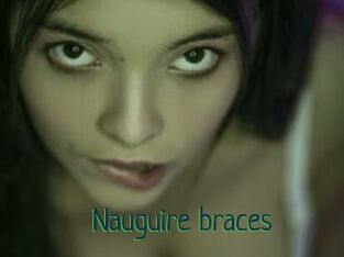 Nauguire_braces